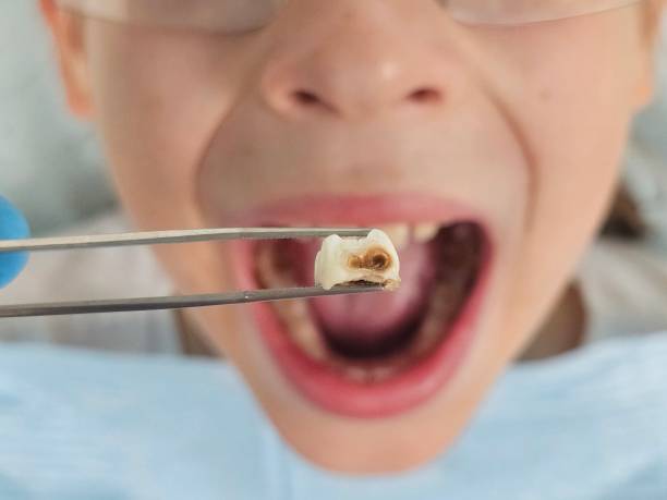 Best Knocked-Out Tooth Emergency  in Walls, MS